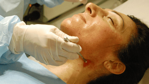 Electroporocosmesis