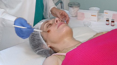 Peeling enzimatico